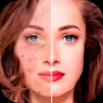 Blemish Remover - Face Editor Icon